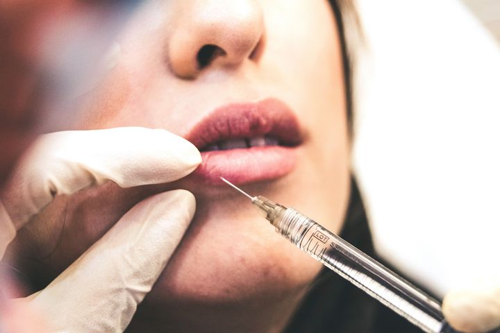 Lippenunterspritzung mit Botox: Eine Behandlung, die in Deutschland nur von qualifiziertem medizinischem Fachpersonal durchgeführt werden darf. Illegale Eingriffe bergen erhebliche Risiken für die Gesundheit. / Foto (c) Sam Moghadam Khamseh, unsplash